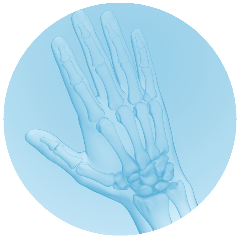 Osteorartritis